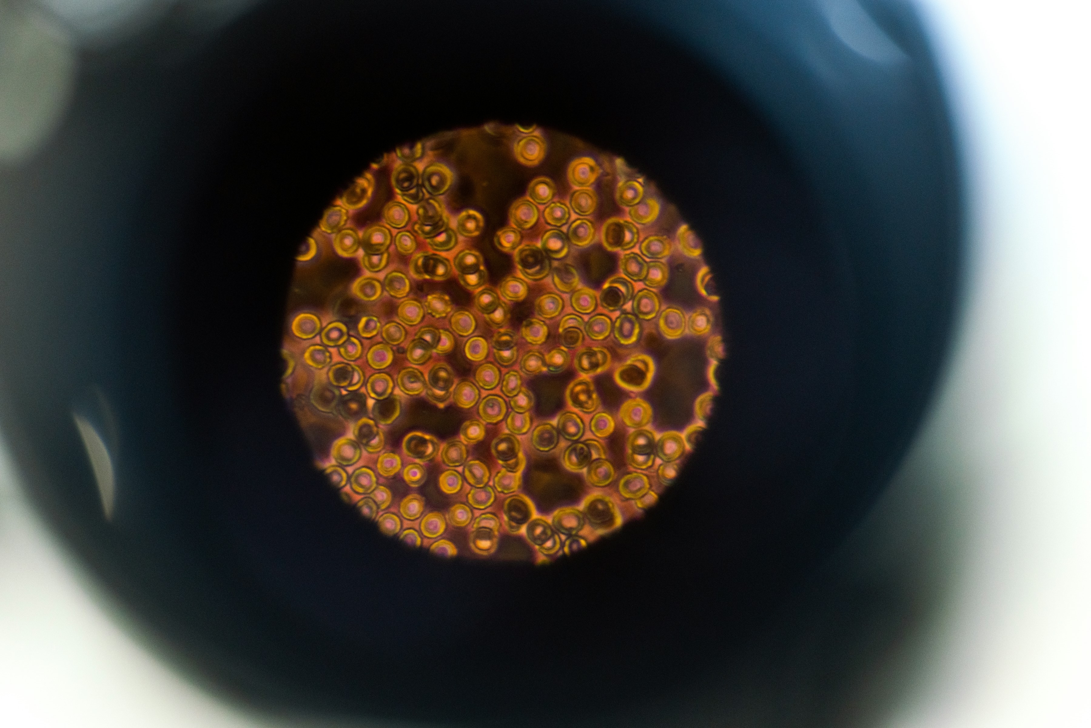 Cells and tissue viewed through a microscope
